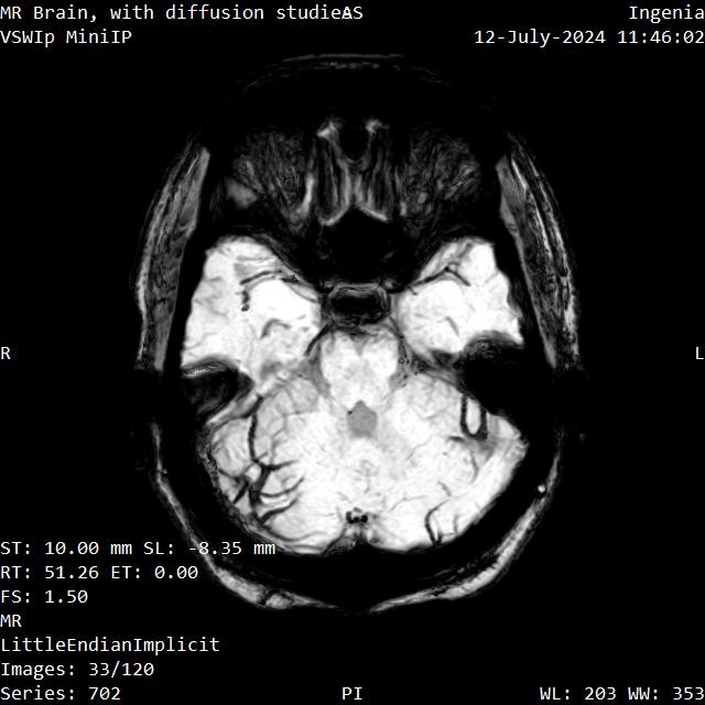 Series 702 image 33