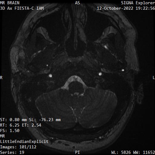 Series 019 image 101