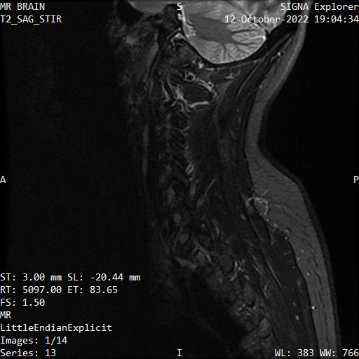 Series 013 image 1
