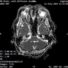 Series 204 image 7