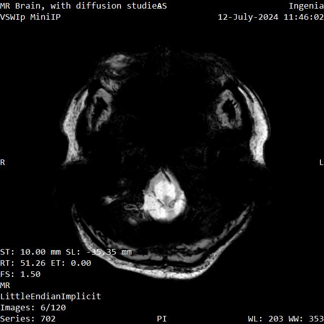 Series 702 image 6