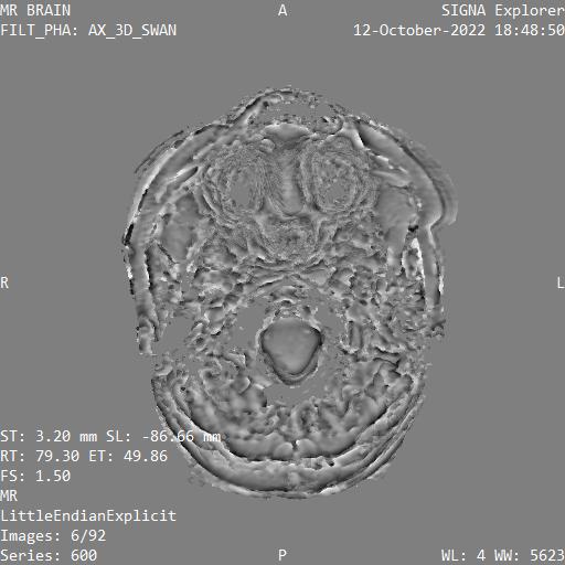Series 600 image 6