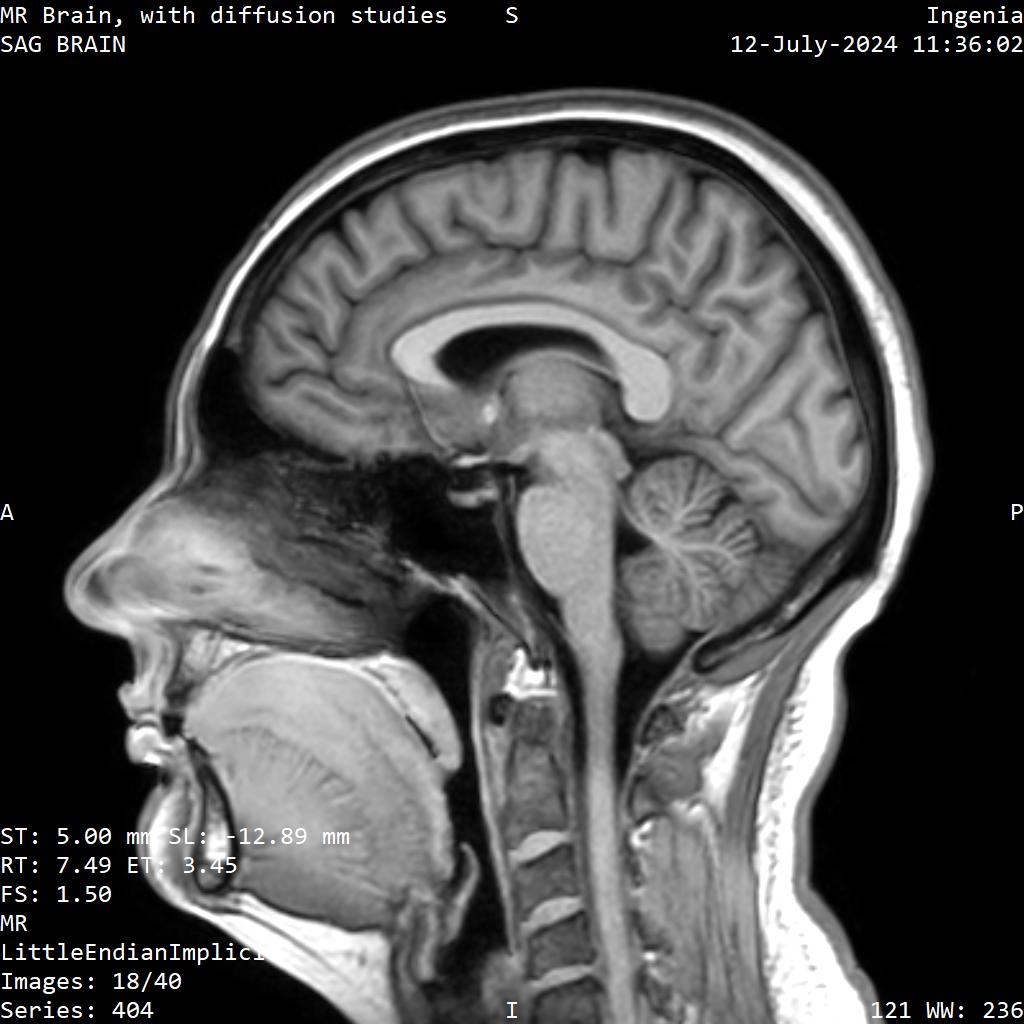 Series 404 image 18