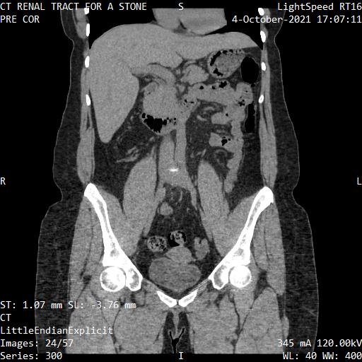 Series 300 image 24