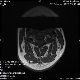 Series 015 image 2