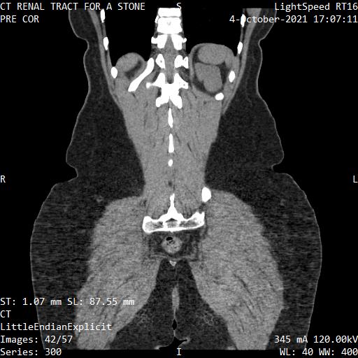 Series 300 image 42