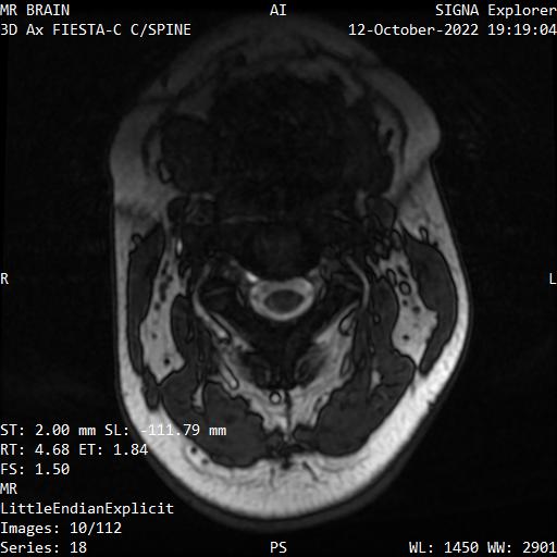 Series 018 image 10