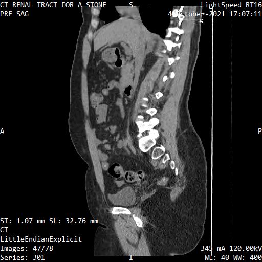 Series 301 image 47