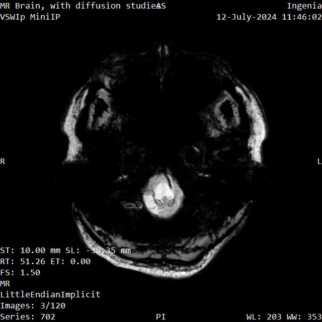 Series 702 image 3
