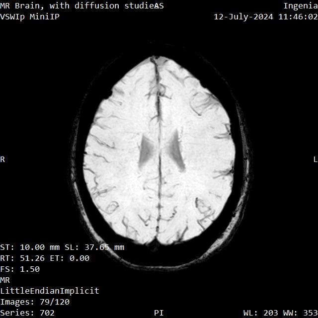 Series 702 image 79