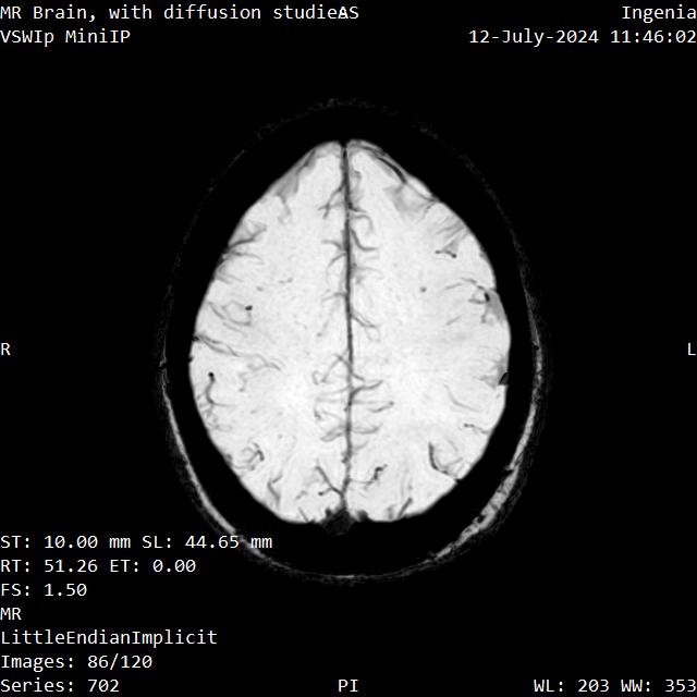 Series 702 image 86