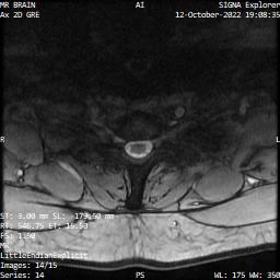 Series 014 image 14