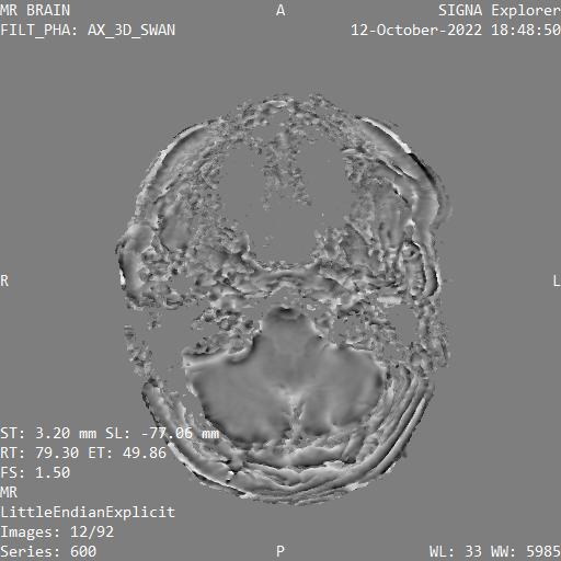 Series 600 image 12
