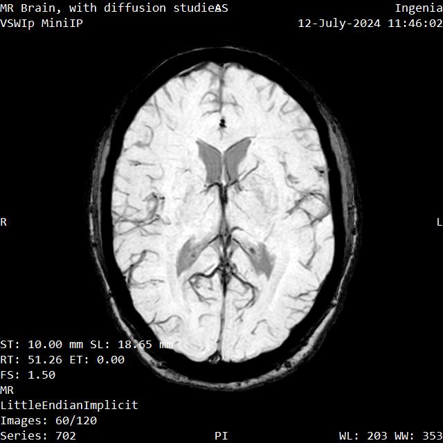 Series 702 image 60