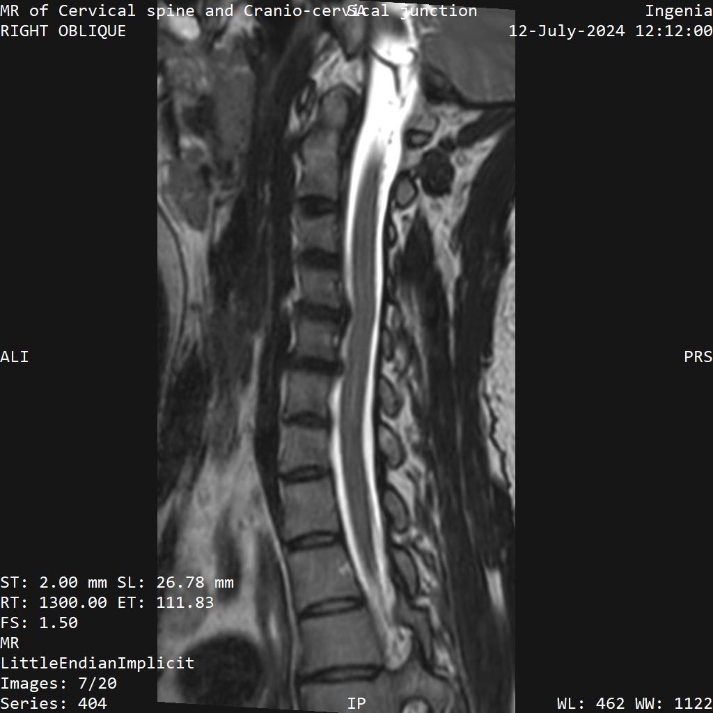 Series 404 image 7