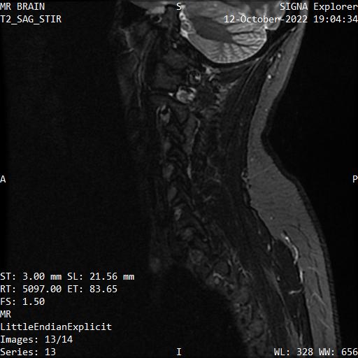 Series 013 image 13