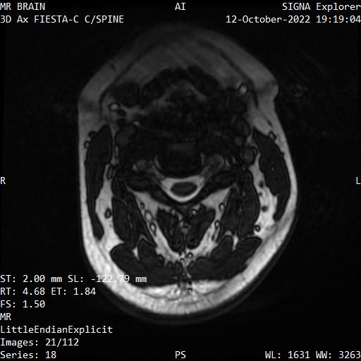 Series 018 image 21
