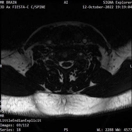 Series 018 image 69