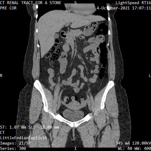 Series 300 image 21
