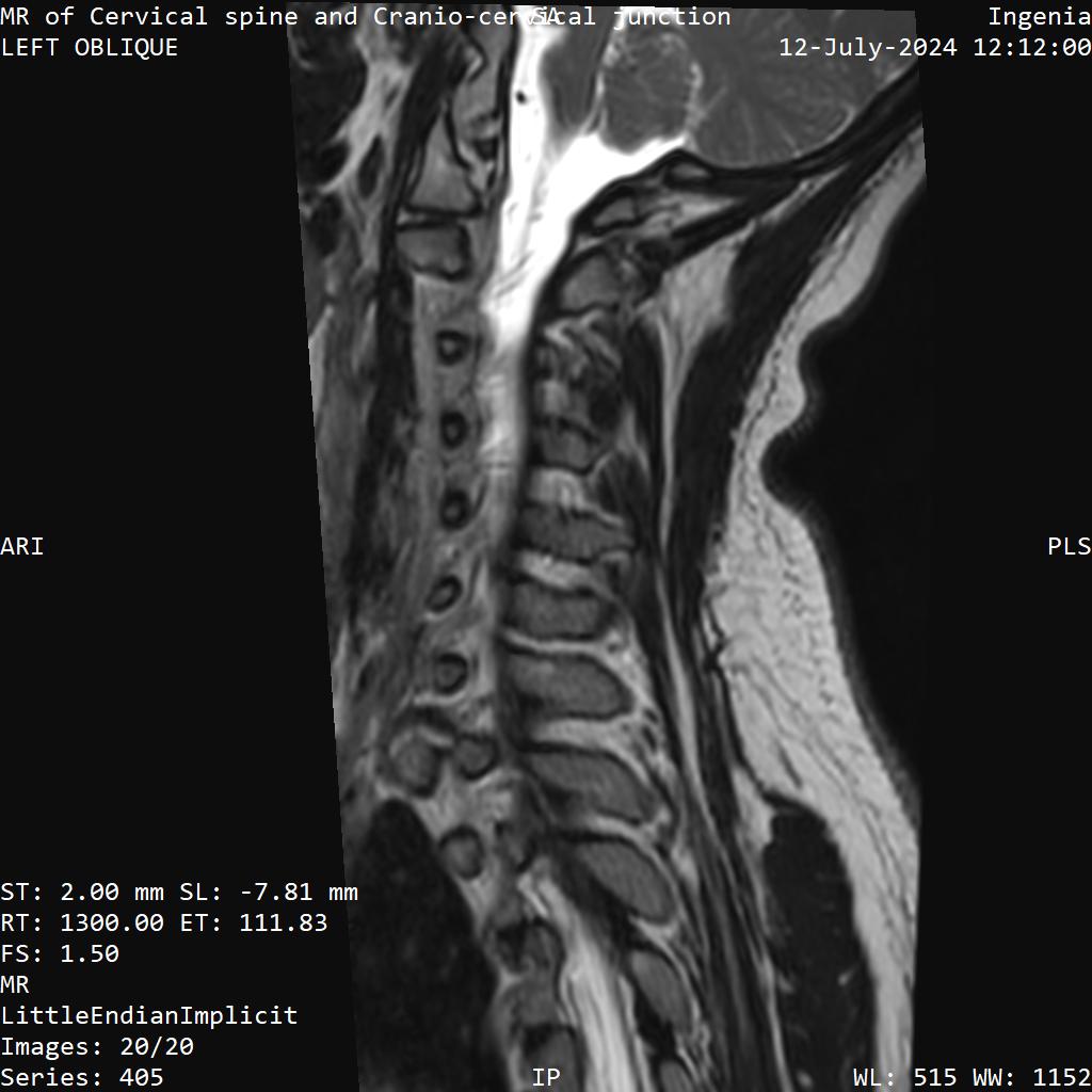 Series 405 image 20