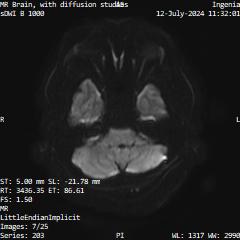 Series 203 image 7