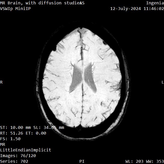 Series 702 image 76