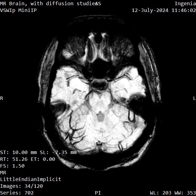 Series 702 image 34