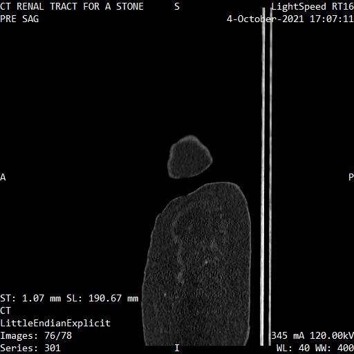 Series 301 image 76