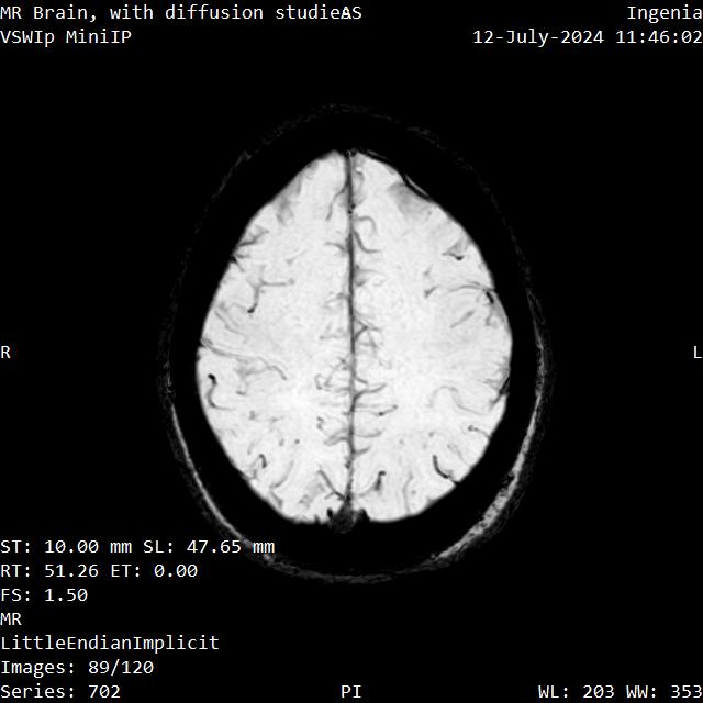 Series 702 image 89