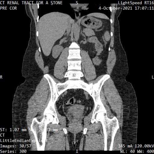 Series 300 image 30