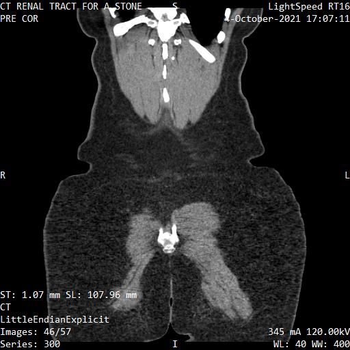 Series 300 image 46