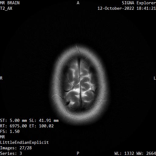 Series 003 image 27