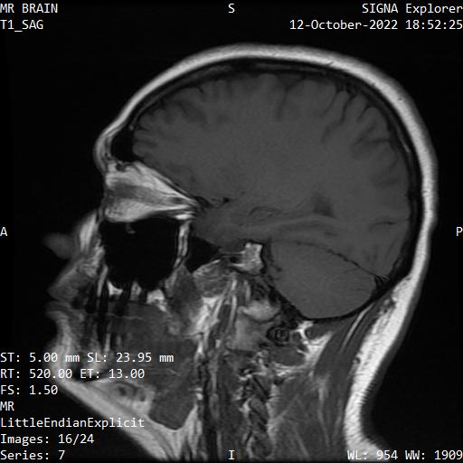 Series 007 image 16