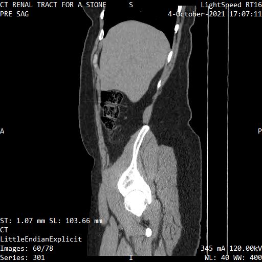Series 301 image 60