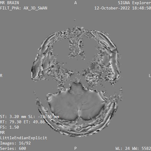 Series 600 image 16