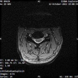 Series 014 image 4