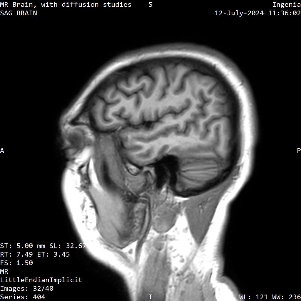 Series 404 image 32