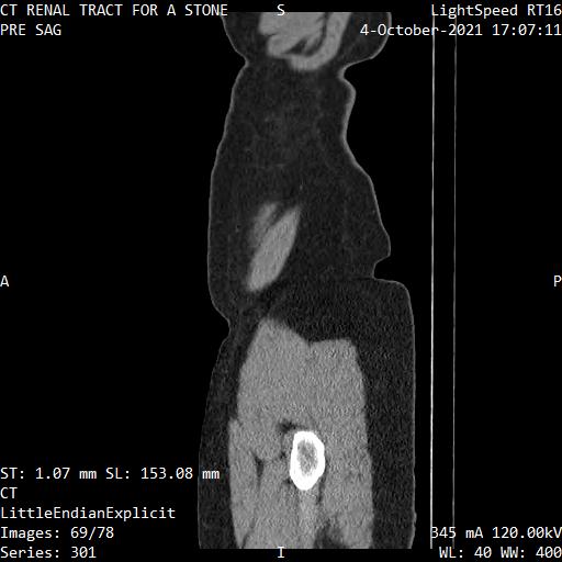 Series 301 image 69