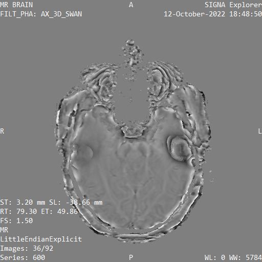 Series 600 image 36