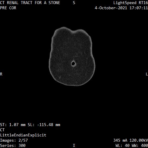 Series 300 image 2