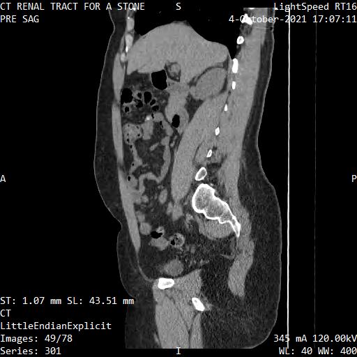 Series 301 image 49
