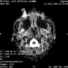 Series 204 image 3