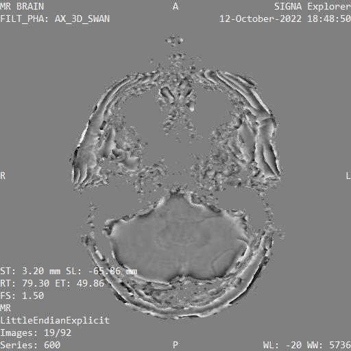 Series 600 image 19