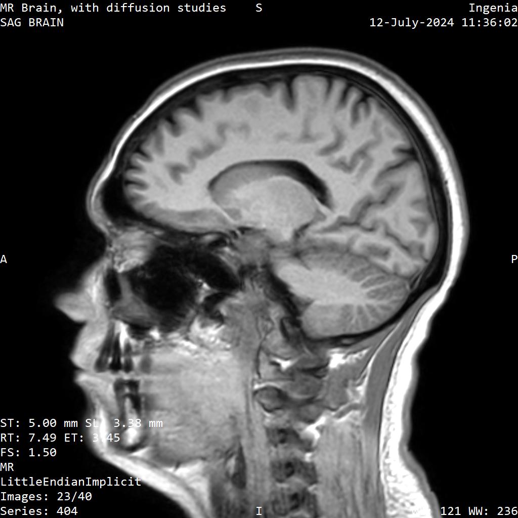 Series 404 image 23