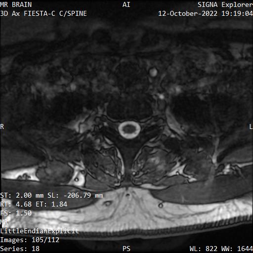 Series 018 image 105