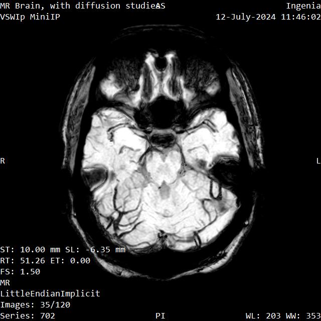 Series 702 image 35