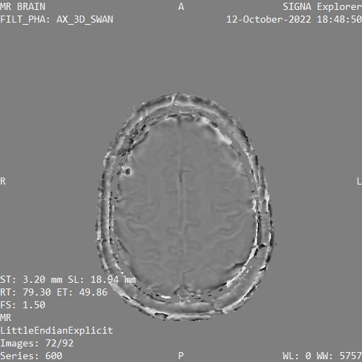 Series 600 image 72