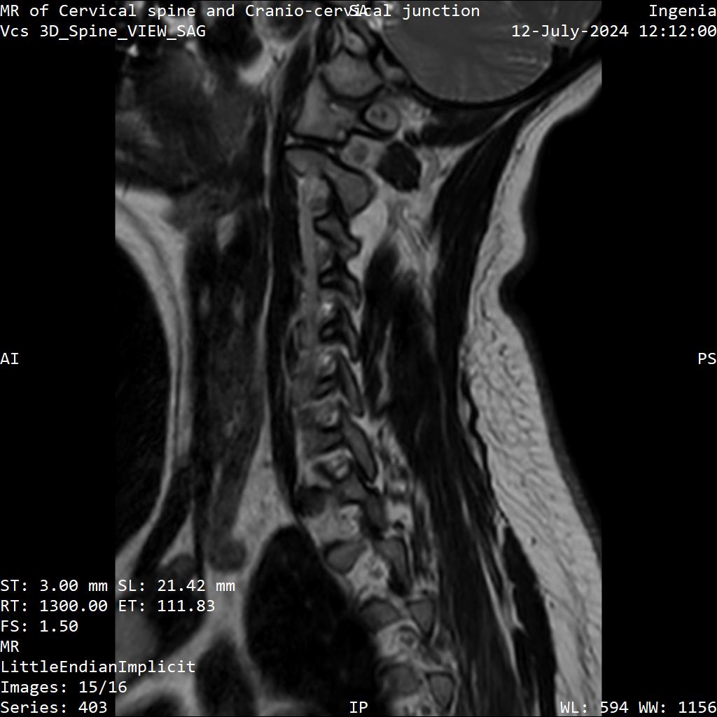 Series 403 image 15