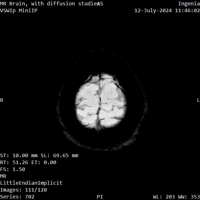 Series 702 image 111