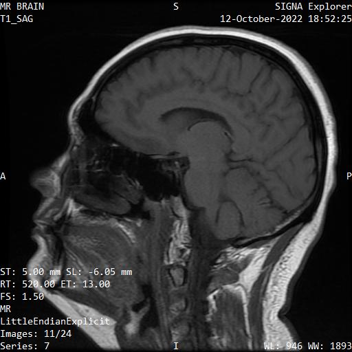 Series 007 image 11